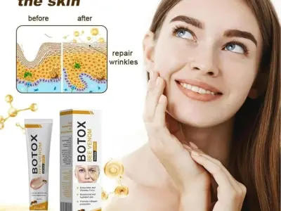 Acne Scar Removal Cream 30ml – Helps Reduce Acne Marks & Scars | For All Skin Types
 - photo 1