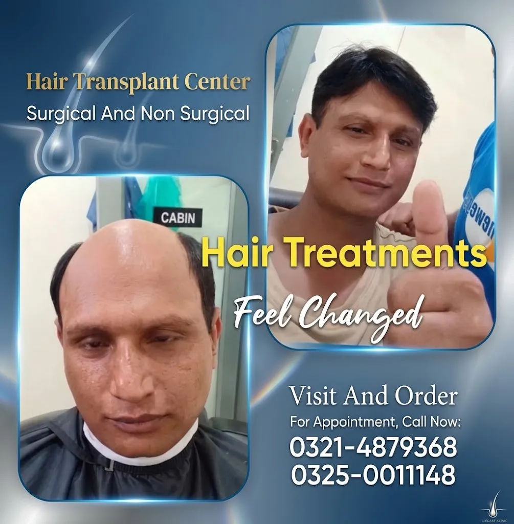 Hair wig, hair patch, hair unit, hair extensions, hair cap