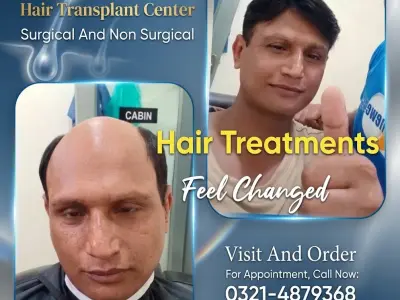 Hair wig, hair patch, hair unit, hair extensions, hair cap