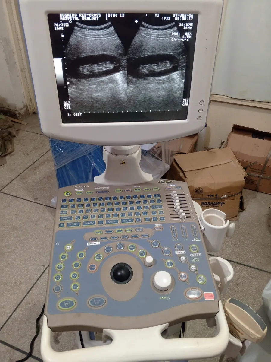 Aloka prosound 6 ultrasound Machine for sale, Contact; 0302-5698121