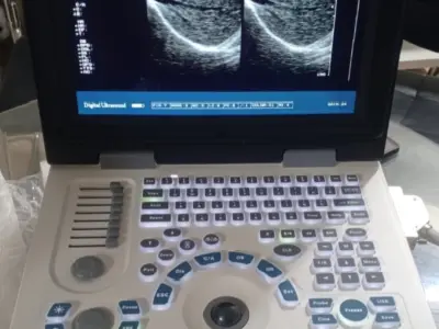 Brand New Nyro10 Ultrasound Machine for sale, - photo 4
