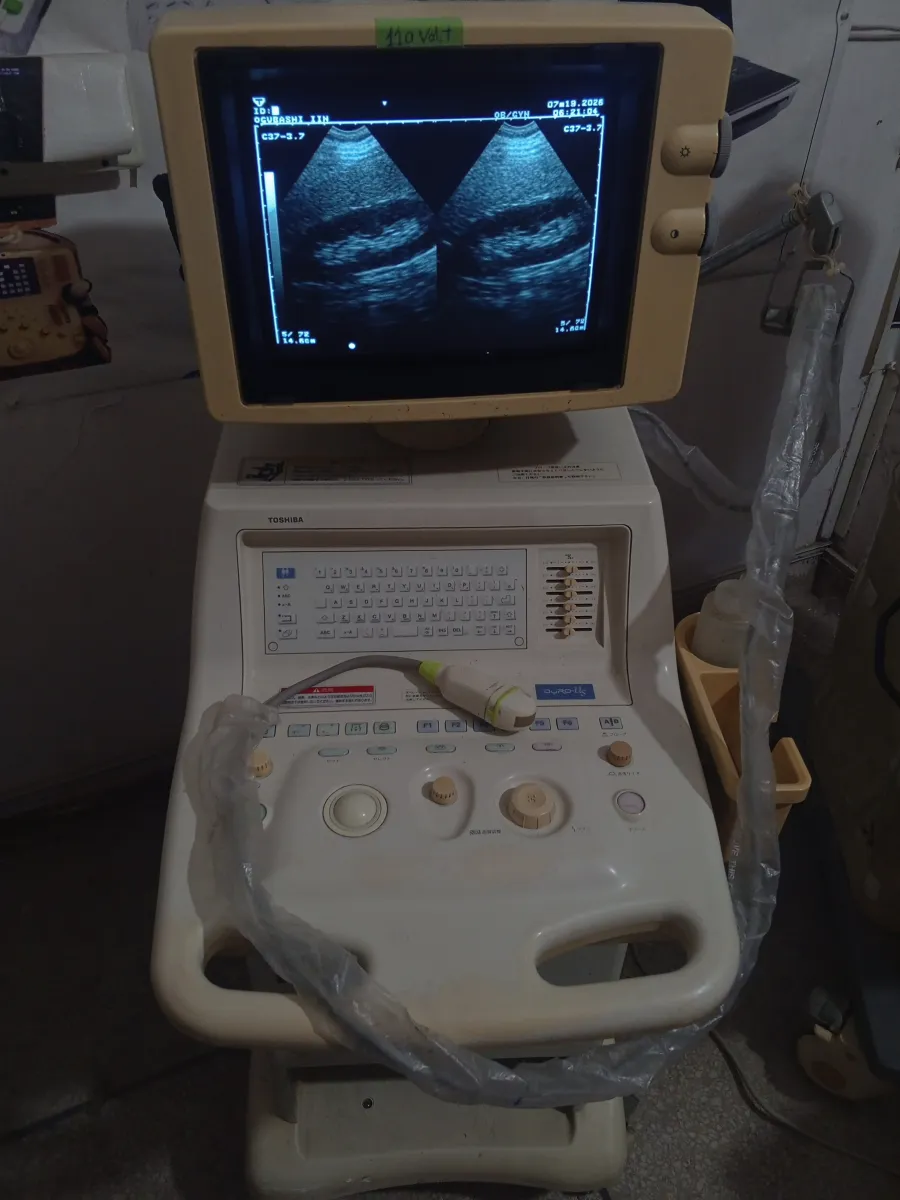 Toshiba ultrasound machine for sale